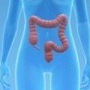 Colon Cancer related image